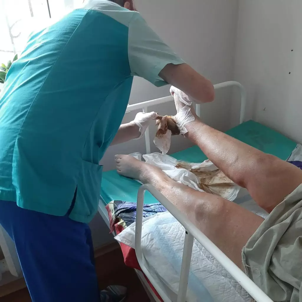 Ежедневные перевязки